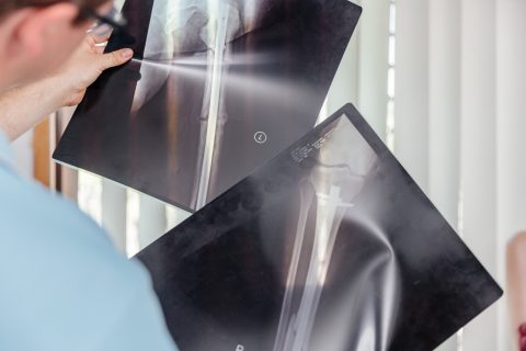 Condition Treatment