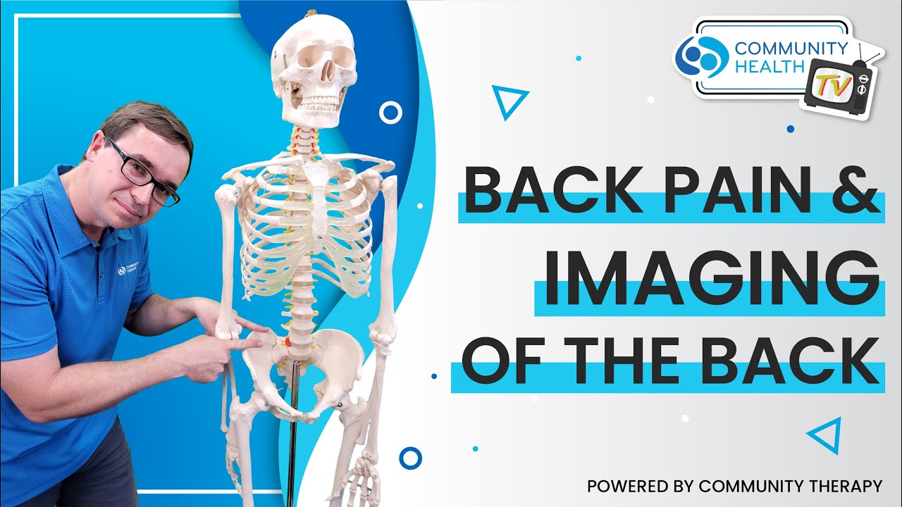 Community Health TV Epsiode 6 thumbnail for back pain and imaging of the back. Scott is pointing at a skeleton